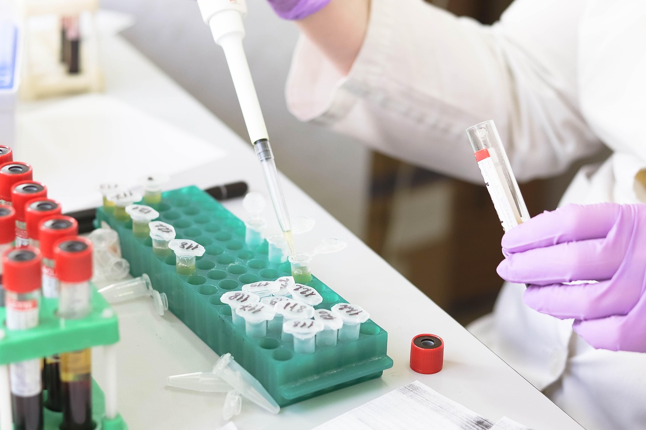 AnaptysBio 실적 발표: 젬페를리, 매출 감소 상쇄할까? - In 참고 이미지